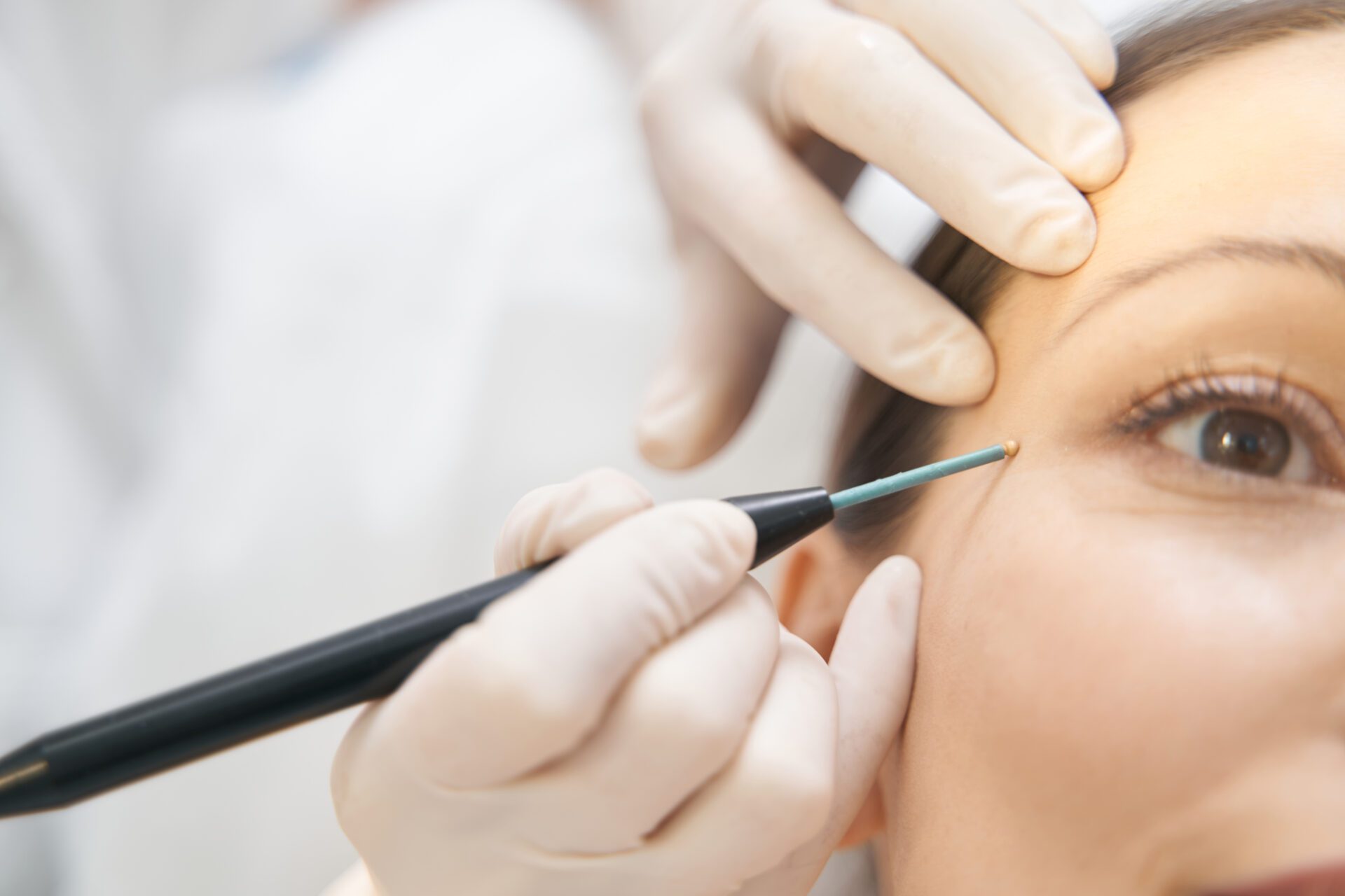 Is Cosmetic Eyelid Surgery Worth It? Benefits Beyond Appearance